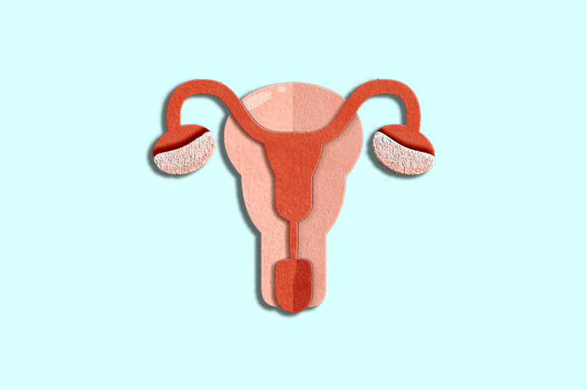 What Is Polycystic Ovary Syndrome? Unpacking the Connections Between Diet and PCOS