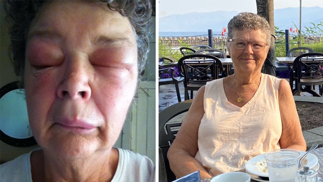 ‘I Fully Expected to Die from This’: How a Whole-Food, Plant-Based Diet Helped Me Heal from a Debilitating Condition