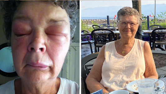 ‘I Fully Expected to Die from This’: How a Whole-Food, Plant-Based Diet Helped Me Heal from a Debilitating Condition