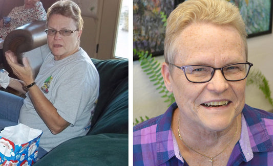 Reversing Chronic Kidney Disease with a Plant-Based Diet